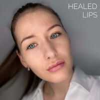 Lippen Pigmentierung.